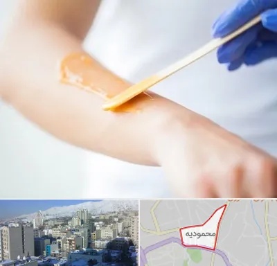 اپیلاسیون کار در محمودیه
