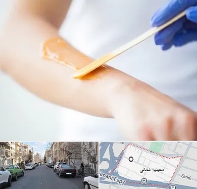 اپیلاسیون کار در مجیدیه شمالی