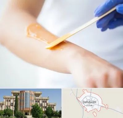 اپیلاسیون کار در دهدشت