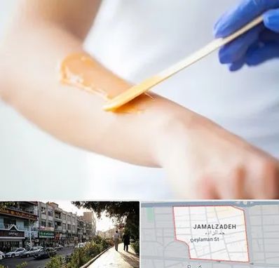 اپیلاسیون کار در خیابان جمالزاده