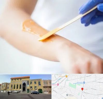 اپیلاسیون کار در زنبیل آباد قم