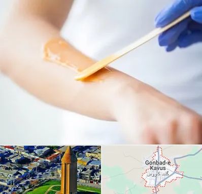 اپیلاسیون کار در گنبد کاووس