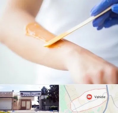 اپیلاسیون کار در وحیدیه شهریار