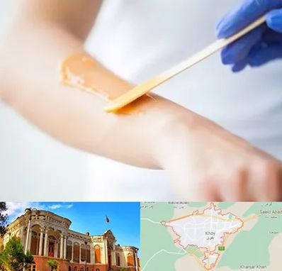 اپیلاسیون کار در خوی