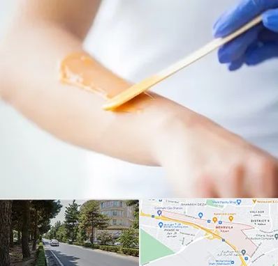 اپیلاسیون کار در مهرویلا کرج