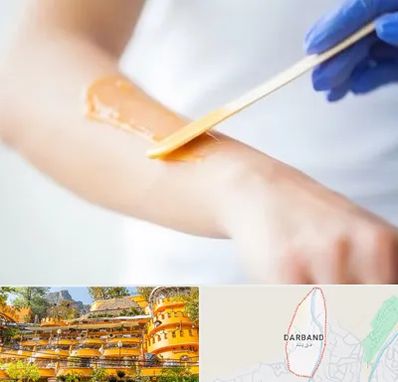اپیلاسیون کار در دربند