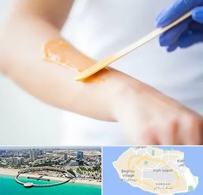 اپیلاسیون کار در کیش