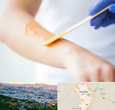 اپیلاسیون کار در سنندج