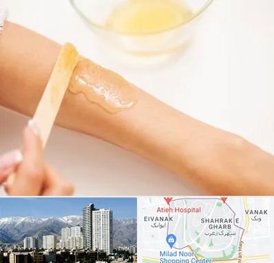 سالن اپیلاسیون در شهرک غرب 