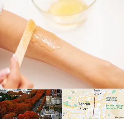 سالن اپیلاسیون در ولیعصر 