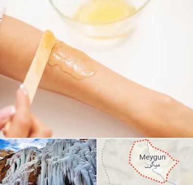 سالن اپیلاسیون در میگون