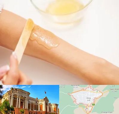 سالن اپیلاسیون در خوی