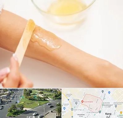 سالن اپیلاسیون در شاهین ویلا کرج