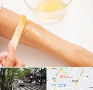 سالن اپیلاسیون در ظفر 