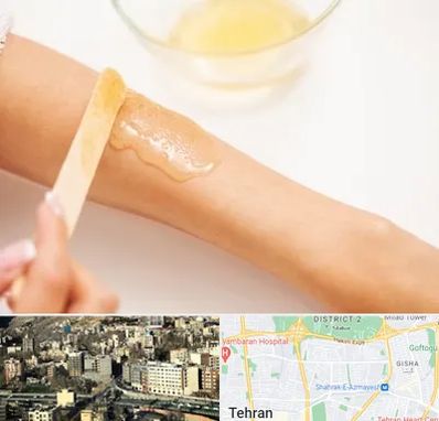 سالن اپیلاسیون در مرزداران 