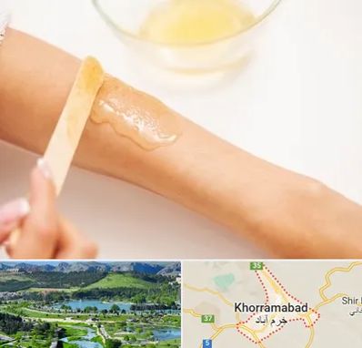 سالن اپیلاسیون در خرم آباد