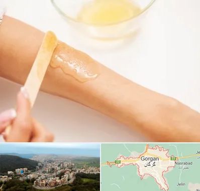 سالن اپیلاسیون در گرگان