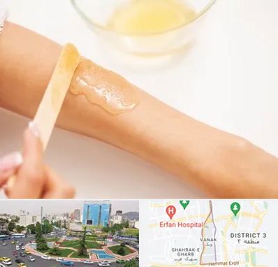 سالن اپیلاسیون در ونک 