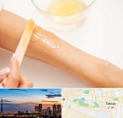 سالن اپیلاسیون در غرب تهران 