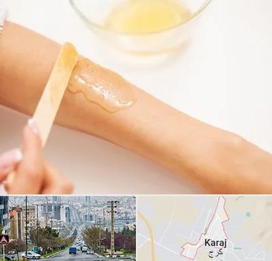 سالن اپیلاسیون در گوهردشت کرج 