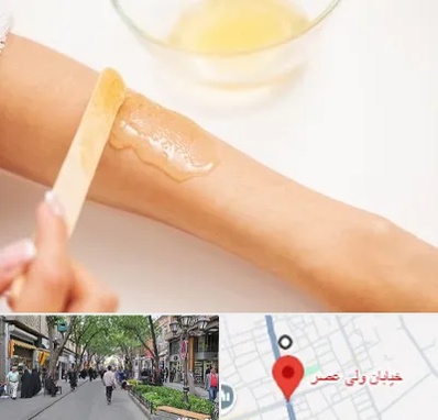 سالن اپیلاسیون در ولیعصر شهریار