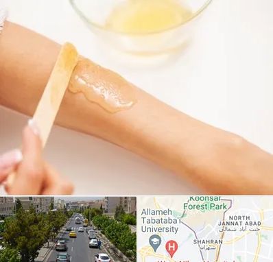 سالن اپیلاسیون در شهران 