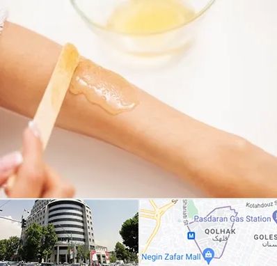 سالن اپیلاسیون در قلهک 