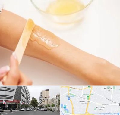 سالن اپیلاسیون در بلوار فردوس 