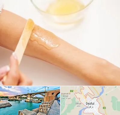 سالن اپیلاسیون در دزفول