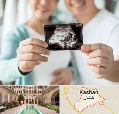 آزمایشگاه غربالگری در کاشان