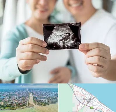 آزمایشگاه غربالگری در تنکابن