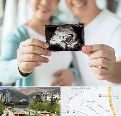 آزمایشگاه غربالگری در شهر زیبا 