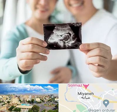 آزمایشگاه غربالگری در میانه