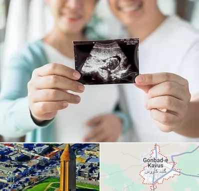 آزمایشگاه غربالگری در گنبد کاووس