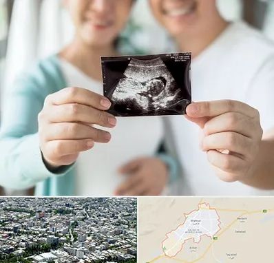 آزمایشگاه غربالگری در شاهرود