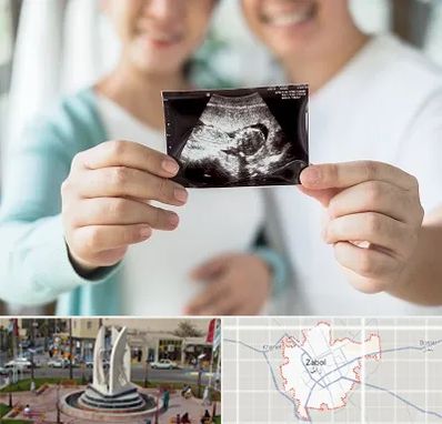 آزمایشگاه غربالگری در زابل