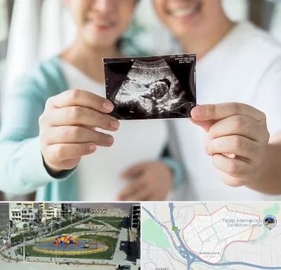 آزمایشگاه غربالگری در مرزداران تبریز