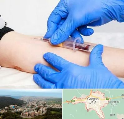 آزمایشگاه ازدواج در گرگان