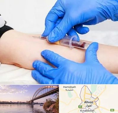 آزمایشگاه ازدواج در اهواز