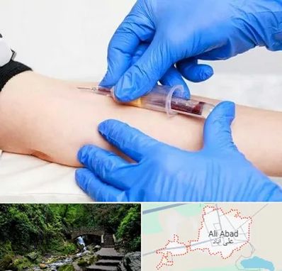 آزمایشگاه ازدواج در علی‌ آباد کتول
