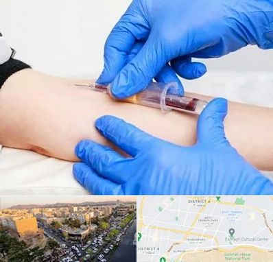 آزمایشگاه ازدواج در تهرانپارس 