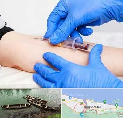 آزمایشگاه ازدواج در بندر انزلی