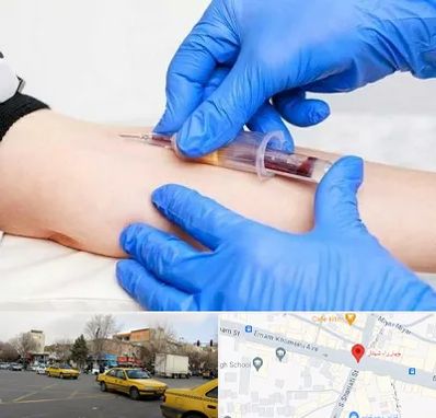 آزمایشگاه ازدواج در شهناز تبریز