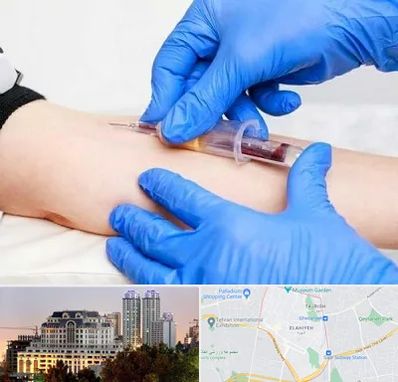 آزمایشگاه ازدواج در فرشته 