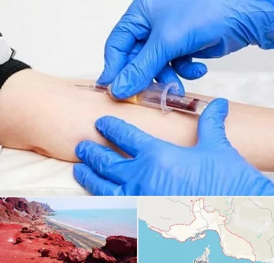 آزمایشگاه ازدواج در هرمزگان