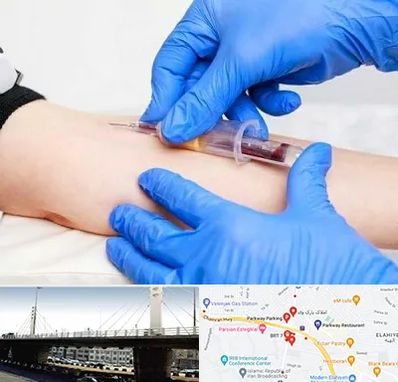 آزمایشگاه ازدواج در پارک وی 