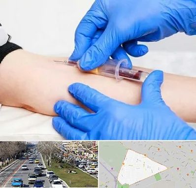 آزمایشگاه ازدواج در احمدآباد مشهد