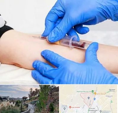 آزمایشگاه ازدواج در باغستان کرج