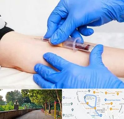 آزمایشگاه ازدواج در بلوار گیلان رشت