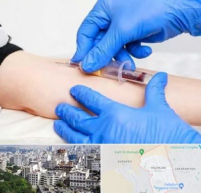 آزمایشگاه ازدواج در ولنجک 